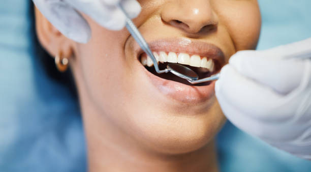 Best Pediatric Emergency Dentist in Beckett Ridge, OH