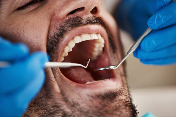 Best Weekend Emergency Dentist in Beckett Ridge, OH