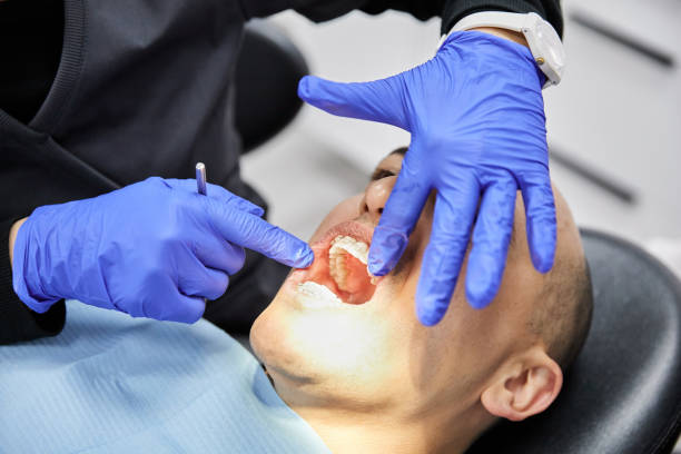 Best Emergency Tooth Extraction in Beckett Ridge, OH