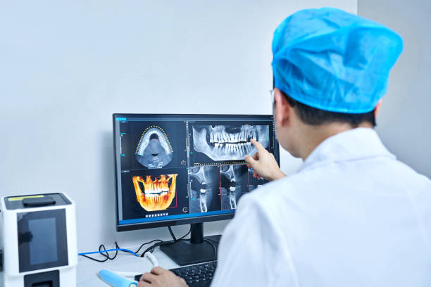 Best Emergency Tooth Extraction in Beckett Ridge, OH