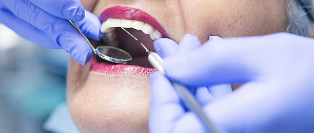 Best Emergency TMJ Treatment in Beckett Ridge, OH